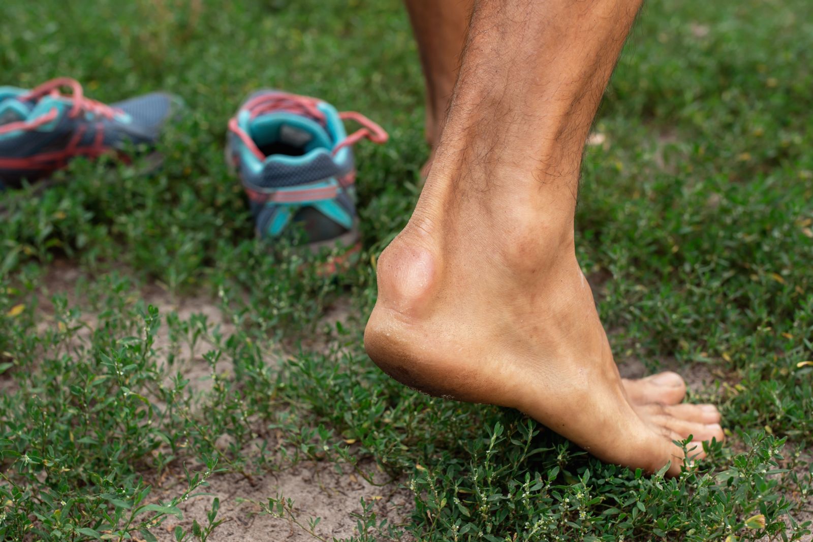 Is the painful bump on the back of my heel a bone spur? Tanglewood